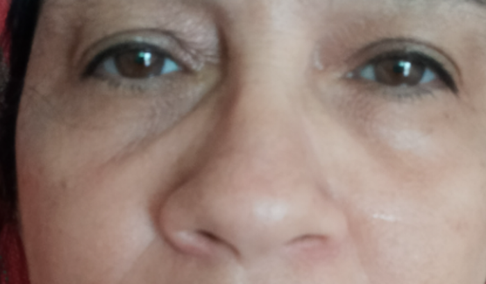 Para um tratamento de coluna e hérnia de disco, estou para não anda, choro. Muito de dores