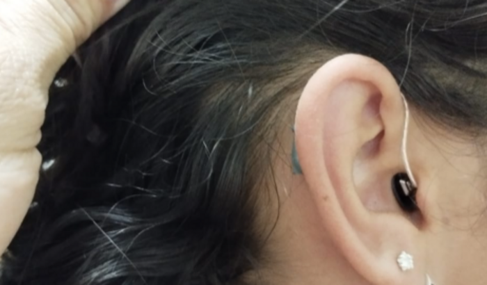 Vaquinha Em Prol do Aparelho Auditivo da Ana Julia