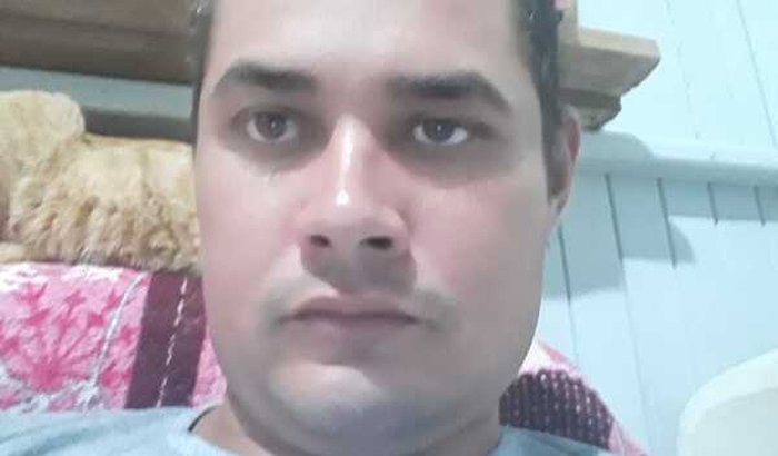 Tratamento Do Douglas