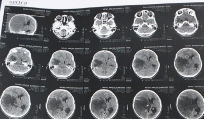 ajuda para o tratamento do câncer do rafa 