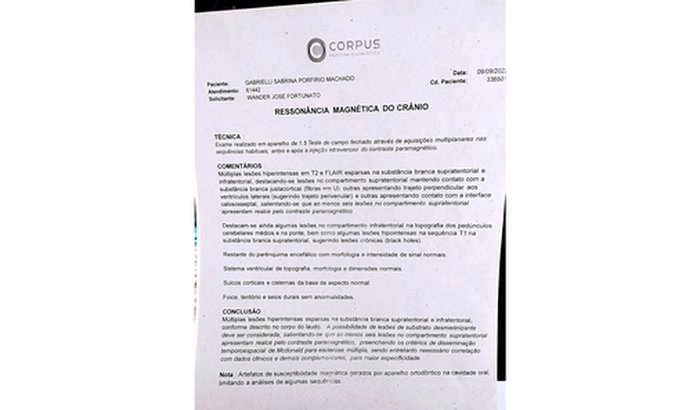 Doença crônica autoimune degenerativa