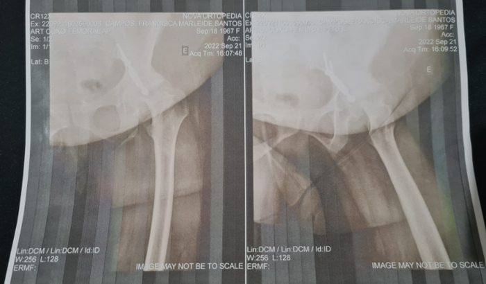 UM SONHO DE VIVER NOVAMENTE UMA VIDA NORMAL