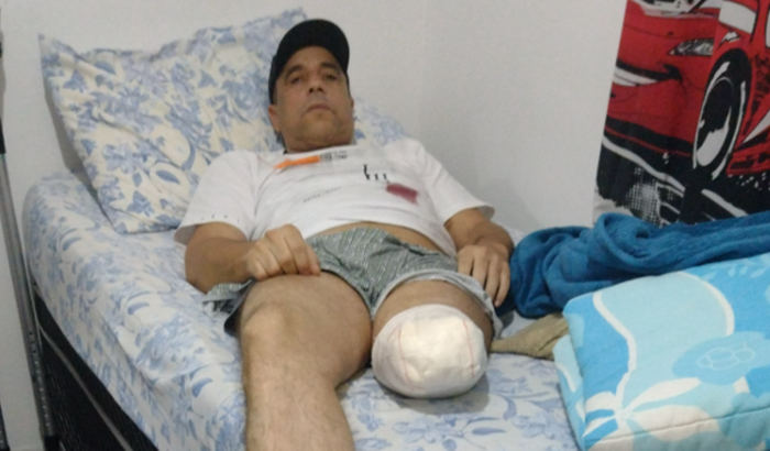 Prótese perna esquerda