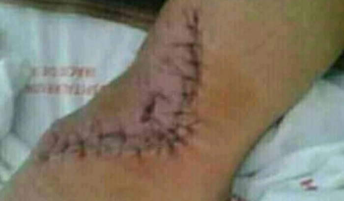 ESTOU COM PROBLEMAS,COLUNA ,CRISES DE ANSIEDADE,DEPRESSÃO,TRABALHAVA MUITO RUIM NÃO TER O QUE COMER. q.trabalha em casa