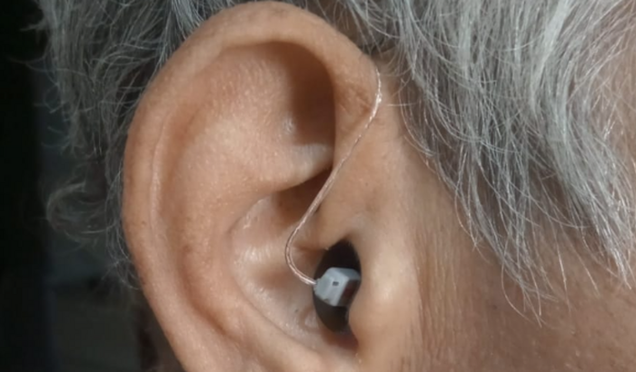 APARELHO AUDITIVO - ANA CLAUDIA N BENAION