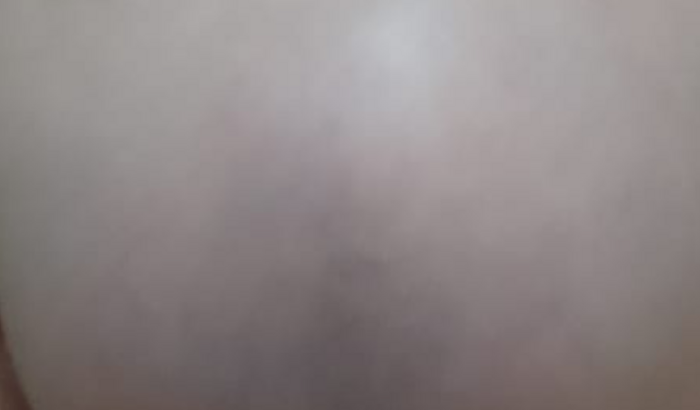 Exame para cirurgia de Michelly