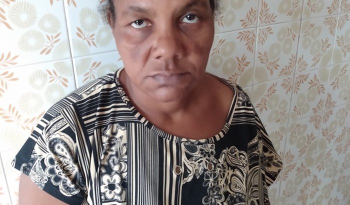 Cirurgia Cateterismo Cardíaco