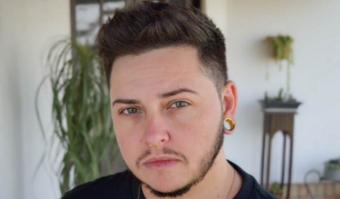 Mastectomia do Zayon