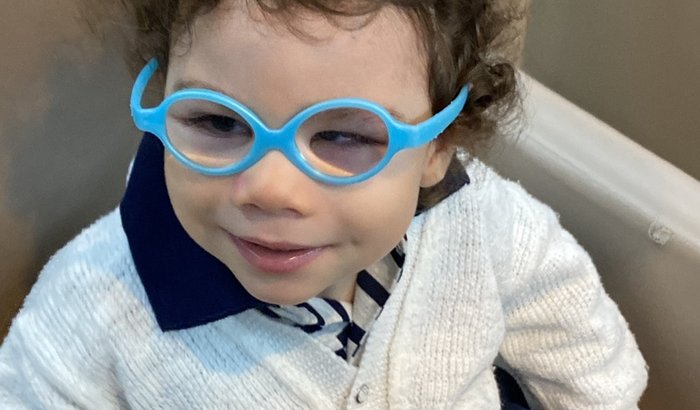 Rael- Aplicação Botox / Toxoplasmose Congênita