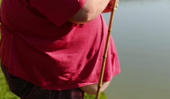 Fazer cirurgia bariátrica 