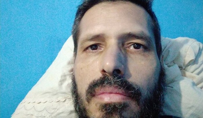 Preciso de ajuda para tratamento do exofo.