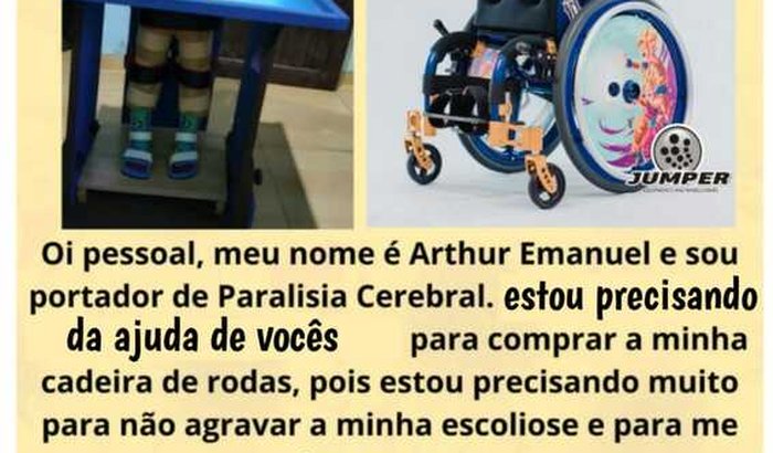 Ajuda pra comprar a cadeira de rodas de Arthur Emanuel 