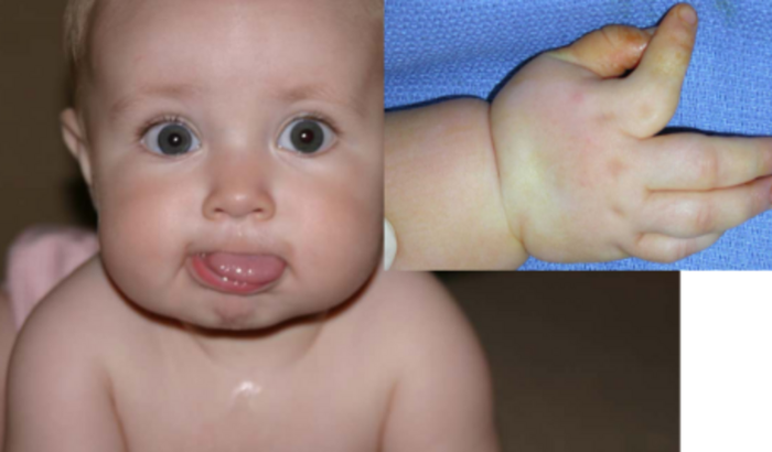 Ajude o anjinho Fabio com a cirurgia