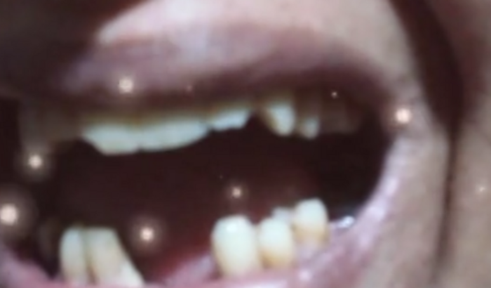 Dentes para minha mãe