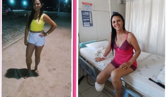 Ajuda para comprar prótese da perna direita de Darliane Maciel