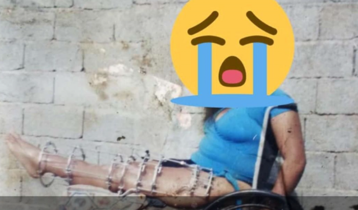 Ajude a Tia Erika (PCD)