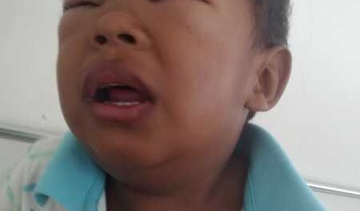 Ajuda para o tratamento  de meu filho Keverson ele esta com Síndrome Nefrótica tem apenas 3 aninhos