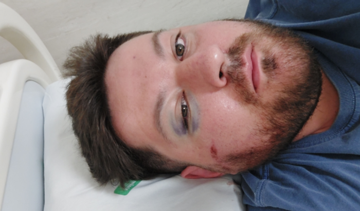 Cirurgia no Rosto - Matheus Carneiro Botelho