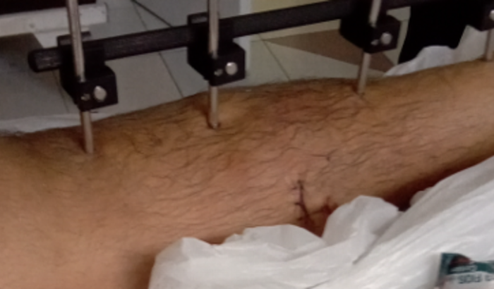 Ajuda a Samuel e sua família.