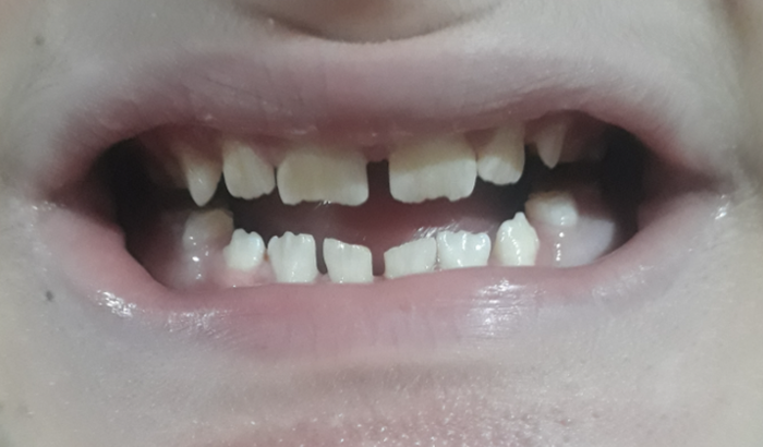 Tratamento bucal para a Livia