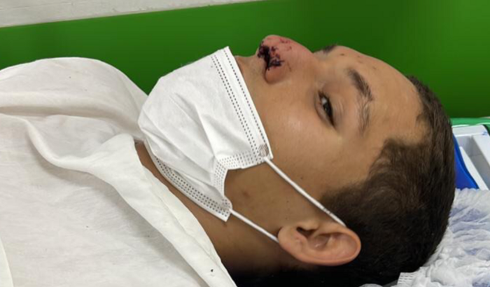 Ajudar no tratamento José Neto