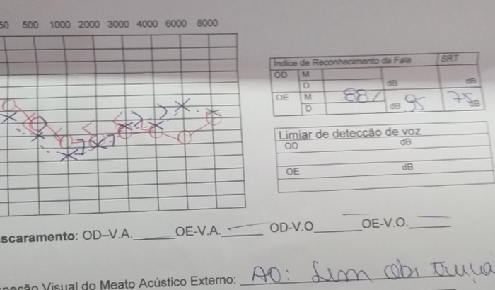 Ajuda para comprar aparelho auditivo 