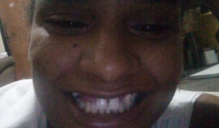 Ajuda para arrumar meus dentes 