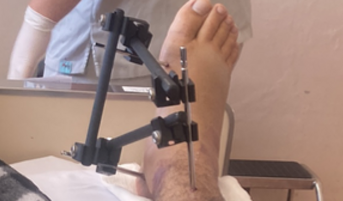 Ajuda com tratamento de saúde