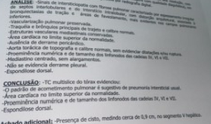 Recuperação de sequela de COVID , pneumonia bacterial