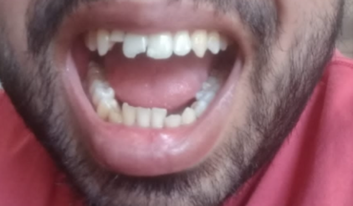 AJUDE AO FELIPE A SORRIR NOVAMENTE 