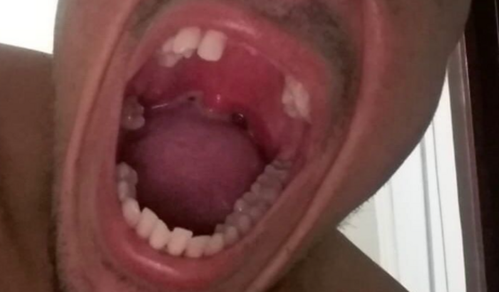 Prótese dental para nosso amigo