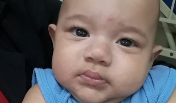 Ajuda para o tratamento de Ruan Felipe- Síndrome de West