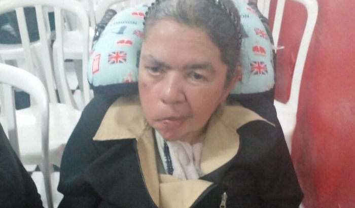 Ajuda para o tratamento da Dinaide