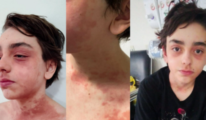 Ajude com o tratamento do Enzo!!!