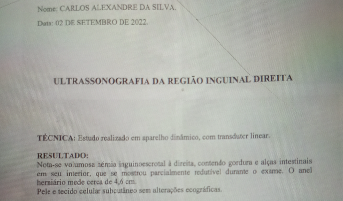 Cirurgia para retirada de hérnia 