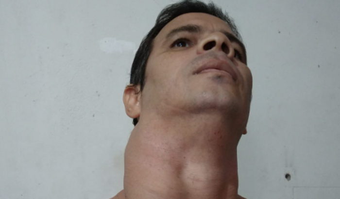 Quimioterapia Rafael