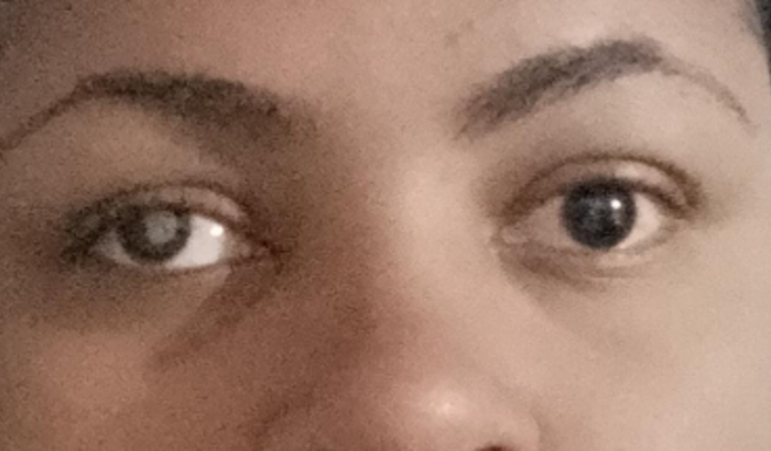 Preciso da sua ajuda para não perder a visão.