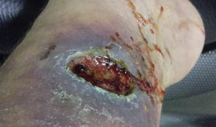 Ajudar Emilhano com o tratamento para poder voltar a trabalhar