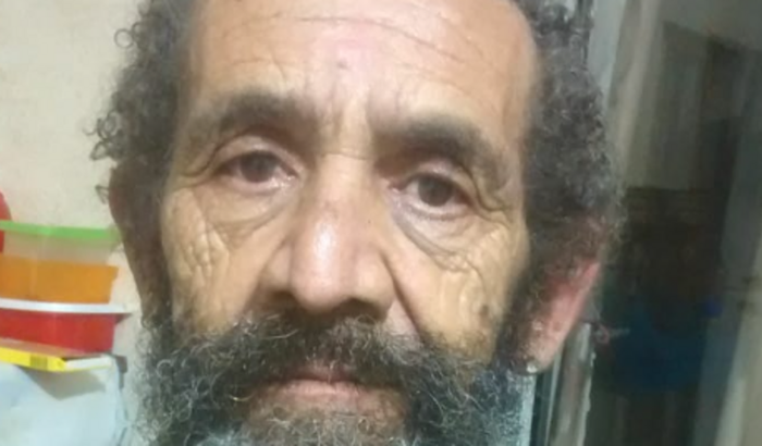 APARELHO DE SURDEZ E ÓCULOS