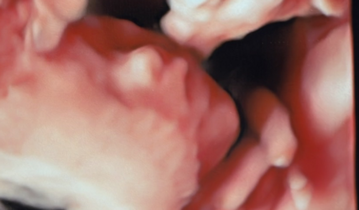 Chá sem chá da Maria Antônia 💝