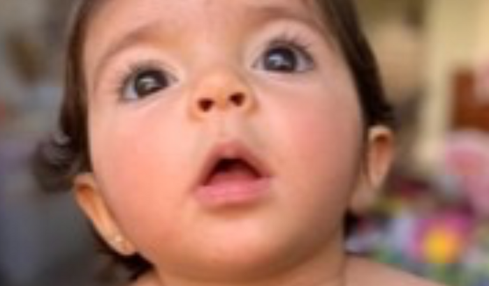 Kyara tem uma doença rara