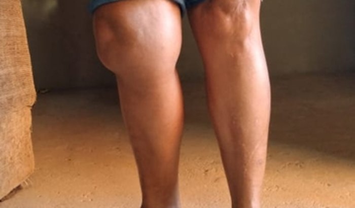 Ajuda pra fazer uma cirugia