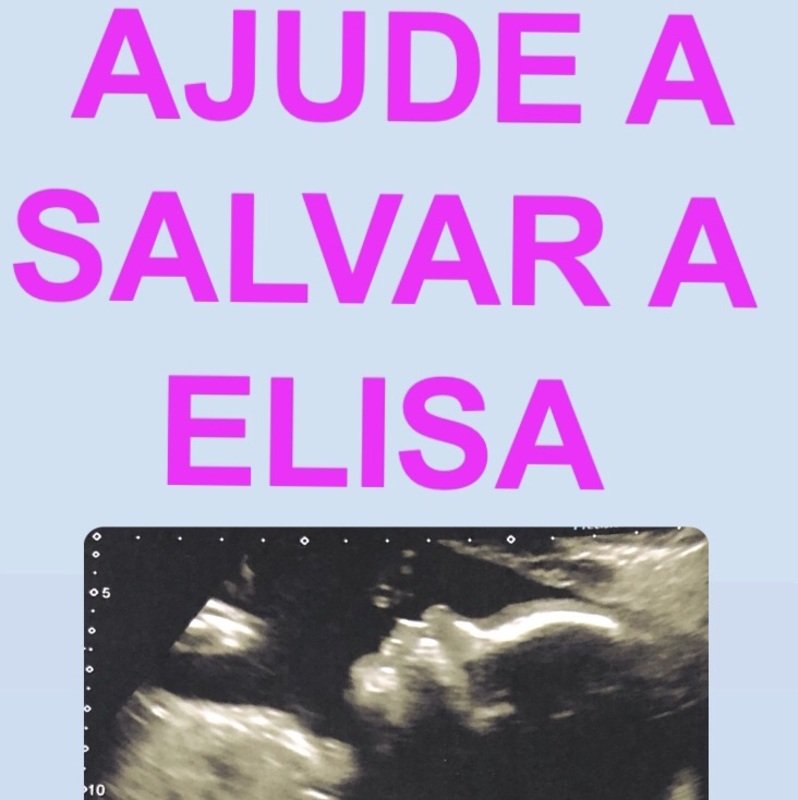 imagem da vaquinha Ajude a salvar a bebê Elisa