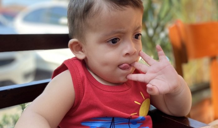 Cirurgia Ravi Fernando 