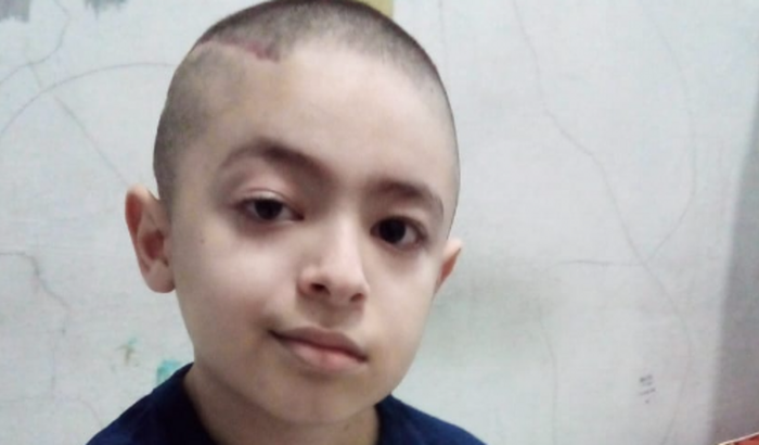 Ajude na luta contra um T.U no SNC