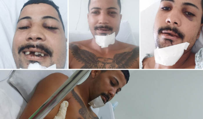 Ajuda para minha próteses dentária fixa.