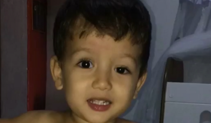 Ajuda para realização de cirurgia de Ptose Palpebral Congênita.