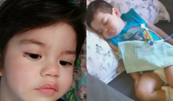 Ajuda no tratamento do Joaquim