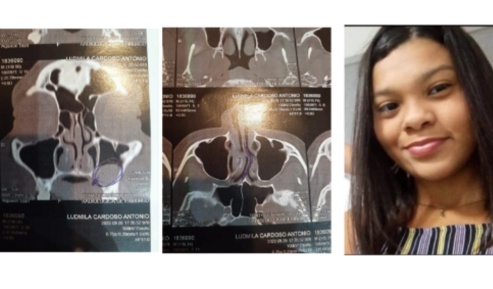 Cirurgia De Urgência Da Lud