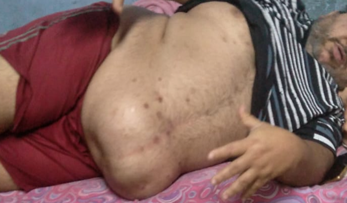 Vaquinha para o Marcelo Belo da Silva